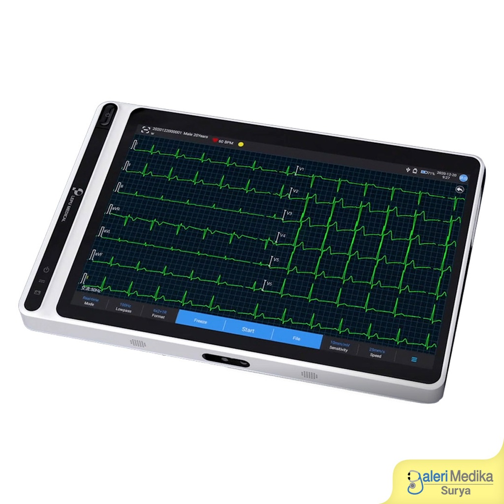 EKG Tablet Nubion NEO ECG S120 AI Smart Electrocardiogram Touch Screen