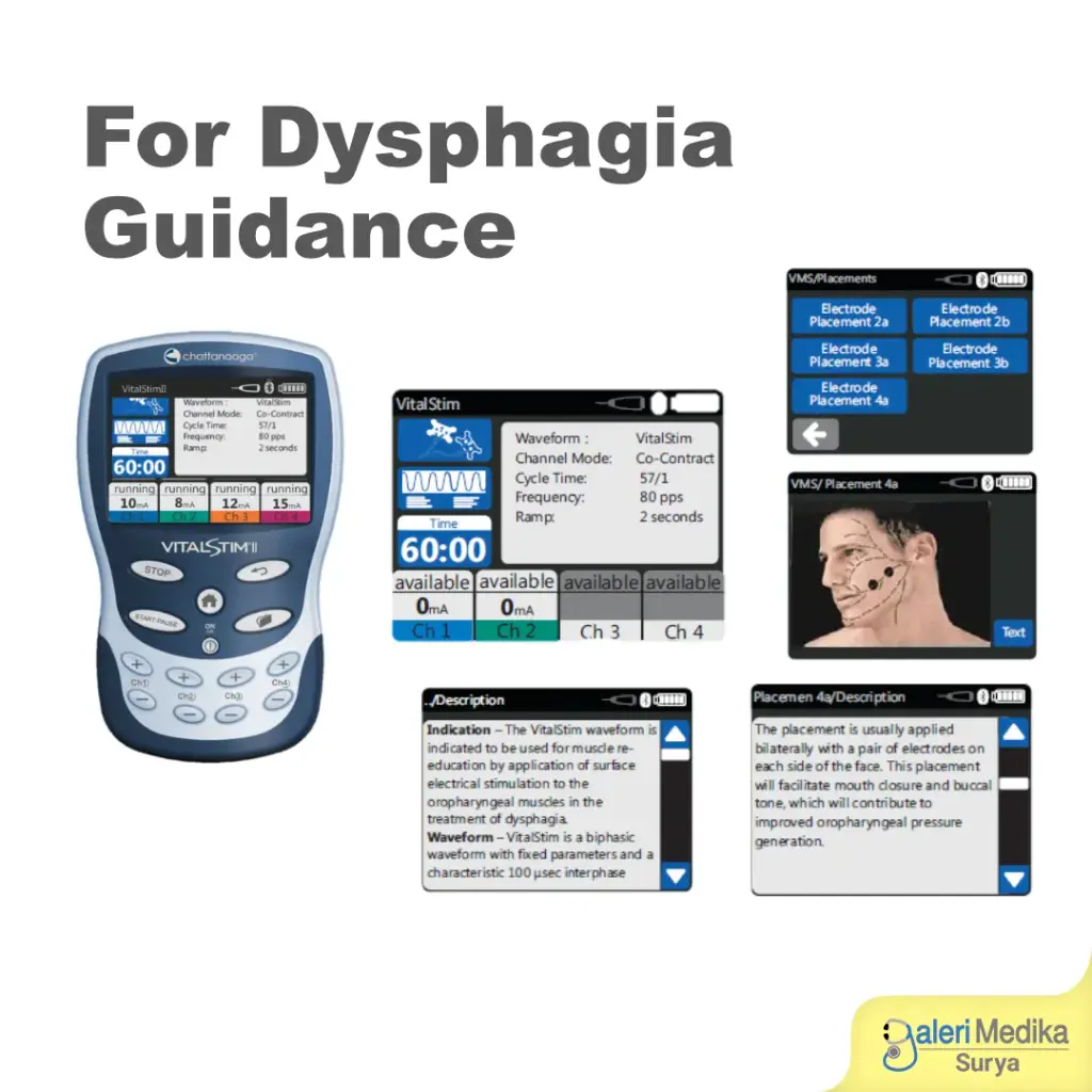Alat Terapi Disfagia Chattanooga VitalStim Plus Portable Electrotherapy
