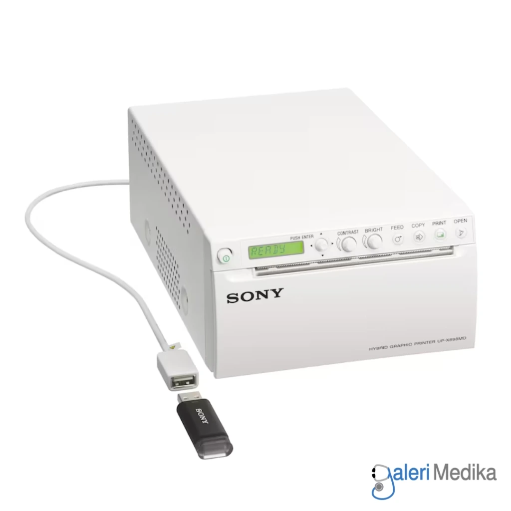 sony-up-x898md-2.webp