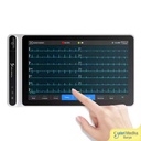 ECG Tablet Nubion NeoECG S120 AI Smart Electrocardiogram Touch Screen